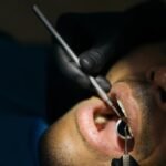 Detailed close-up of a dental examination with instruments in a clinical setting.