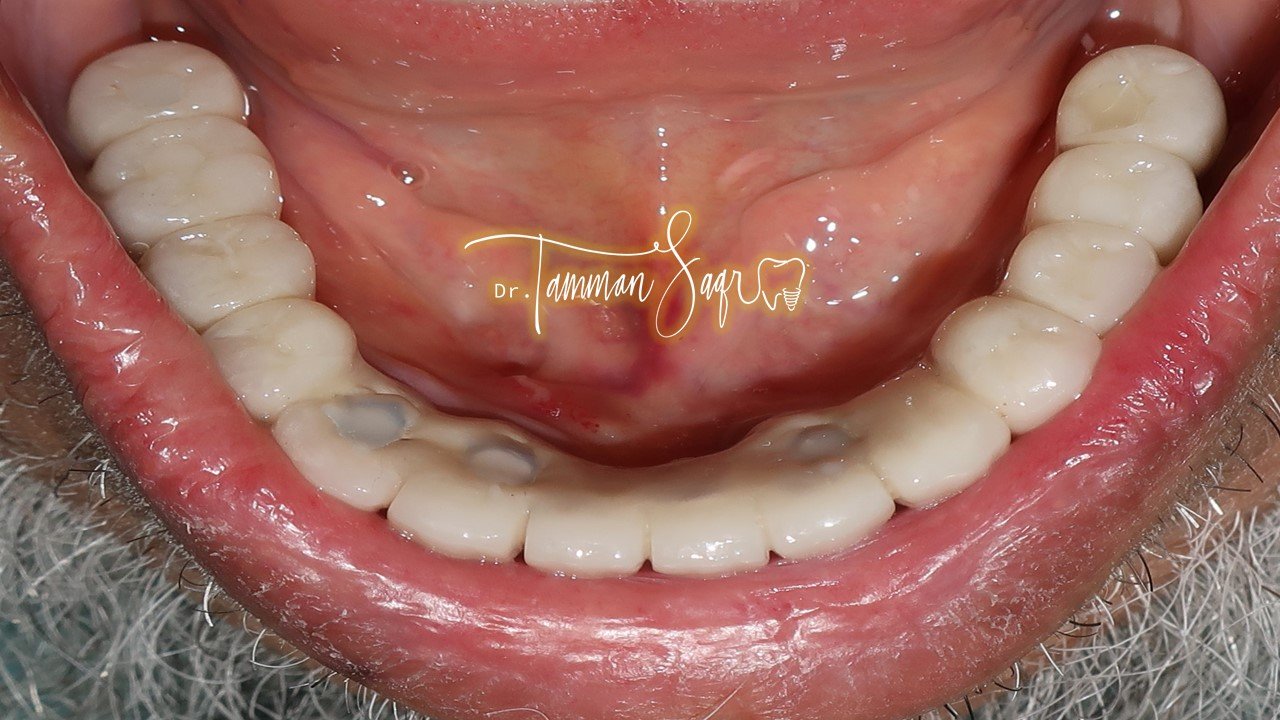 Slide13